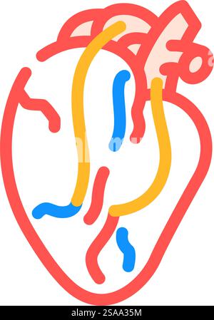 Farbsymbolvektor für Herz-Bypass-Chirurgie. Herzbypassoperationszeichen. Isolierte Symboldarstellung. Herz-Bypass-Chirurgie Farbsymbolvektor-Illustration Stock Vektor