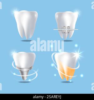 Zahnärztliche Leistungen, vektorisolierte Illustration. Weißer brillanter gesunder Zahn, Zahnspangen, Implantat und Zahnaufhellung. Zahnheilkunde Konzept für Poster, Banner, Website-Seite usw. Professionelle zahnärztliche Dienstleistungen Vektorkonzept isolierte Illustration Stock Vektor