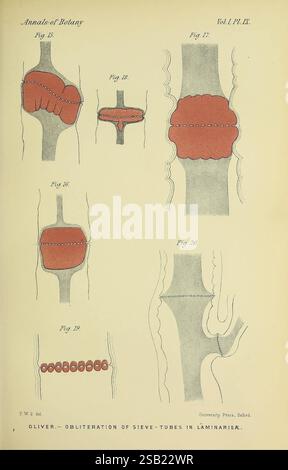 Annals of Botany London Botany Periodicals Plants präsentiert die Illustration eine Reihe von Diagrammen, die sich auf die Erforschung der Botanik beziehen, wobei der Schwerpunkt auf die Vernichtung von Siebrohren in Pflanzenstrukturen, insbesondere in laminaren Pflanzen, gelegt wird. Jede beschriftete Abbildung zeigt verschiedene Stadien oder Formen der Verstopfung des Siebrohrs und betont verschiedene anatomische Aspekte. Die Verwendung von Farben hebt die betroffenen Bereiche hervor, während die begleitenden Abbildungen eine detaillierte Ansicht der zellulären Veränderungen im Zusammenhang mit diesem Prozess bieten. Diese visuelle Darstellung zielt darauf ab, das Verständnis der Pflanzenphysiologie und zu verbessern Stockfoto