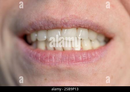 Ein Makrofoto, das ein natürliches Lächeln aufnimmt und Zähne und Lippen detailgetreu hervorhebt. Stockfoto