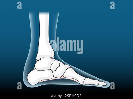 Anatomie der Fussgelenke. Fußknochensymbole wie Röntgenbilder. Beinskelett. Krankheit und Störung der Ferse. Vektorposter. Abbildung „Isometrische Abwicklung“ Stock Vektor