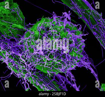 Rasterelektronenmikroskopische Darstellung von Ebola-Viruspartikeln (lila), die sowohl knospend als auch an der Oberfläche infizierter VERO E6-Zellen (grün) befestigt sind, in Halloween-passenden Farben coloriert. Aufnahme in der NIAID Integrated Research Facility in Fort Detrick, Maryland. Stockfoto