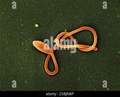 Farbiges Rasterelektronenmikroskop eines einzelnen filamentösen Ebola-Viruspartikels. Aufnahme und Farbverbesserung in der NIAID Integrated Research Facility in ft. Detrick, Maryland. Stockfoto
