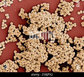 Coloriertes REM von Methicillin-resistenten Staphylococcus aureus (MRSA)-Bakterien. Stockfoto