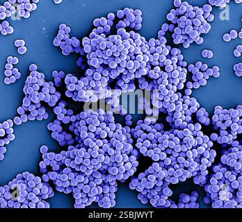 Coloriertes REM von Methicillin-resistenten Staphylococcus aureus (MRSA)-Bakterien. Stockfoto