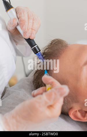 Alopezie. Der Haarausfall des Mannes verbessert die Regeneration der Wachstumsbehandlung, Dermapen-Mikroneedling, Vitamin-Exosomen-Plasmainjektionen. Trichologe Kosmetologe Arzt KopfKopfKopfhautverfahren fraktionelle Mesotherapie Stockfoto