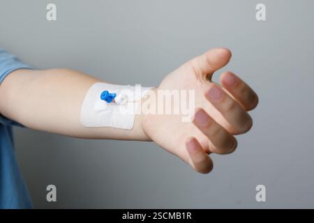 Hand mit peripherem Venenkatheter in der Krankenhausnahmebildung Stockfoto