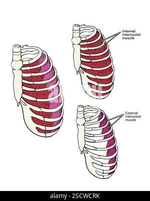 Abbildung des Rippenkäfigs mit Muskelgruppen, einschließlich der inneren Interkostalmuskulatur und der äußeren Interkostalmuskulatur. Stockfoto