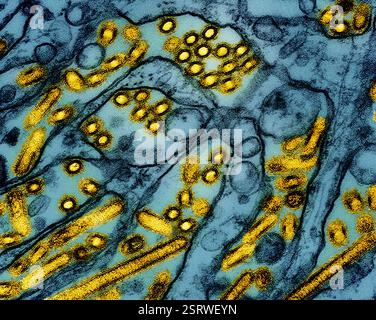 Vogelgrippe-A-Virus (H5N1/Vogelgrippe) Eingefärbtes Transmissionselektronenmikroskop von Vogelgrippe-A-H5N1-Viruspartikeln (gelb), gezüchtet in Madin-Darby-Canine Niere (MDCK)-Epithelzellen (blau). Mikroskopie durch CDC; Repositionierung und Umfärbung durch NIAID. Stockfoto
