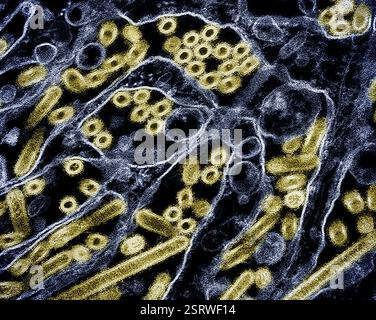 Vogelgrippe-A-Virus (H5N1/Vogelgrippe) Eingefärbtes Transmissionselektronenmikroskop von Vogelgrippe-A-H5N1-Viruspartikeln (gelb), gezüchtet in Madin-Darby-Canine Niere (MDCK)-Epithelzellen (blau). Mikroskopie durch CDC; Repositionierung und Umfärbung durch NIAID. Stockfoto