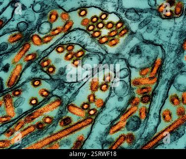 Vogelgrippe-A-Virus (H5N1/Vogelgrippe) Eingefärbtes Transmissionselektronenmikroskop von Vogelgrippe-A-H5N1-Viruspartikeln (gelb), gezüchtet in Madin-Darby-Canine Niere (MDCK)-Epithelzellen (blau). Mikroskopie durch CDC; Repositionierung und Umfärbung durch NIAID. Stockfoto