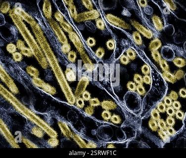 Vogelgrippe-A-Virus (H5N1/Vogelgrippe) Eingefärbtes Transmissionselektronenmikroskop von Vogelgrippe-A-H5N1-Viruspartikeln (gelb), gezüchtet in Madin-Darby-Canine Niere (MDCK)-Epithelzellen (blau). Mikroskopie durch CDC; Repositionierung und Umfärbung durch NIAID. Stockfoto