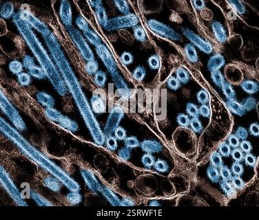 Vogelgrippe-A-Virus (H5N1/Vogelgrippe) Eingefärbtes Transmissionselektronenmikroskop von Vogelgrippe-A-H5N1-Viruspartikeln (gelb), gezüchtet in Madin-Darby-Canine Niere (MDCK)-Epithelzellen (blau). Mikroskopie durch CDC; Repositionierung und Umfärbung durch NIAID. Stockfoto