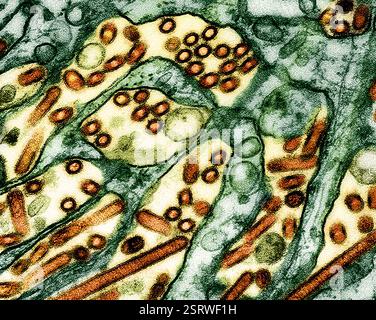 Vogelgrippe-A-Virus (H5N1/Vogelgrippe) Eingefärbtes Transmissionselektronenmikroskop von Vogelgrippe-A-H5N1-Viruspartikeln (gelb), gezüchtet in Madin-Darby-Canine Niere (MDCK)-Epithelzellen (blau). Mikroskopie durch CDC; Repositionierung und Umfärbung durch NIAID. Stockfoto