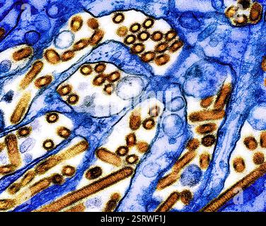 Vogelgrippe-A-Virus (H5N1/Vogelgrippe) Eingefärbtes Transmissionselektronenmikroskop von Vogelgrippe-A-H5N1-Viruspartikeln (gelb), gezüchtet in Madin-Darby-Canine Niere (MDCK)-Epithelzellen (blau). Mikroskopie durch CDC; Repositionierung und Umfärbung durch NIAID. Stockfoto