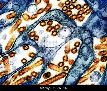 Vogelgrippe-A-Virus (H5N1/Vogelgrippe) Eingefärbtes Transmissionselektronenmikroskop von Vogelgrippe-A-H5N1-Viruspartikeln (gelb), gezüchtet in Madin-Darby-Canine Niere (MDCK)-Epithelzellen (blau). Mikroskopie durch CDC; Repositionierung und Umfärbung durch NIAID. Stockfoto