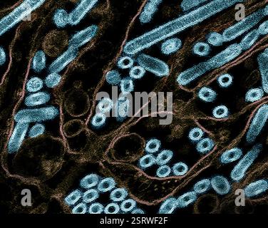 Vogelgrippe-A-Virus (H5N1/Vogelgrippe) Eingefärbtes Transmissionselektronenmikroskop von Vogelgrippe-A-H5N1-Viruspartikeln (gelb), gezüchtet in Madin-Darby-Canine Niere (MDCK)-Epithelzellen (blau). Mikroskopie durch CDC; Repositionierung und Umfärbung durch NIAID. Stockfoto