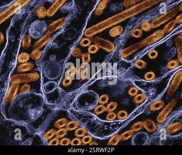 Vogelgrippe-A-Virus (H5N1/Vogelgrippe) Eingefärbtes Transmissionselektronenmikroskop von Vogelgrippe-A-H5N1-Viruspartikeln (gelb), gezüchtet in Madin-Darby-Canine Niere (MDCK)-Epithelzellen (blau). Mikroskopie durch CDC; Repositionierung und Umfärbung durch NIAID. Stockfoto