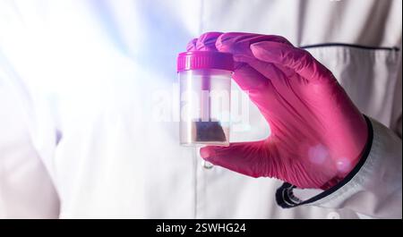 Laborassistent des Arztes in einem rosa Handschuh hält einen Stuhltest. Konzept zur Untersuchung des Stuhls auf Helminthen und Rundwürmer, Nahaufnahme. Kopierraum für Textil Stockfoto