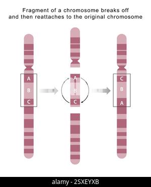 Ein Fragment kann gebrochen und in umgekehrter Ausrichtung wieder verbunden werden, wodurch das Fragment innerhalb eines Chromosoms umgekehrt wird Stockfoto