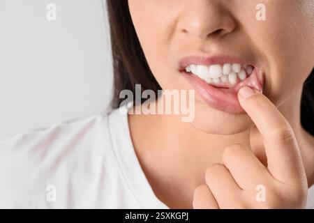Junge Frau, die Zähne auf hellem Hintergrund zeigt, Nahaufnahme Stockfoto