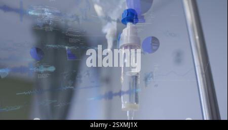 Bild der Datenverarbeitung und Diagramme über Tropfen im Krankenhaus Stockfoto