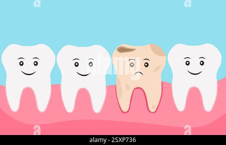 Zahnkaries. Plaque-Zähne. Zahnkaries. Zahnhygiene. Mundzahnheilkunde. Zahnheilkunde, Zähneputzen. Vektorabbildung. Draufsicht Stock Vektor