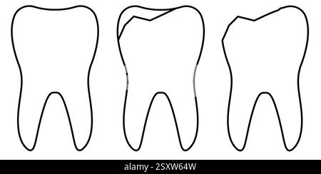 Illustration gesunder und beschädigter Zähne Umrisse, die zahnärztliche Konzepte zeigen Stock Vektor