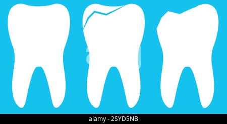 Illustration gesunder, abgebrochener und gebrochener Zähne auf blauem Hintergrund Stock Vektor
