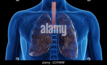 Raucherlunge, Illustration. Stockfoto