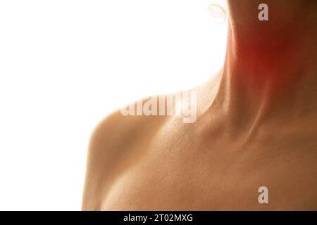 Weiblicher Hals mit einem roten Fleck in der Mitte des Halses auf einem hellen Hintergrund, Halsschmerzen, Halsschmerzen, Grippe und Gesundheit Stockfoto