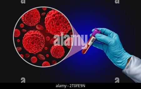 Blutkrebs-Screening-Test als onkologische medizinische Diagnose für Tumormarker als flüssige Biopsie zur Früherkennung mit malignen Zellen zur Diagnose Stockfoto