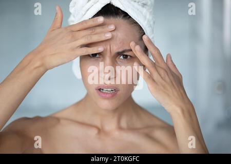 Ängstliche Frau, die sich Sorgen um Gesichtsfalten oder Akne macht Stockfoto