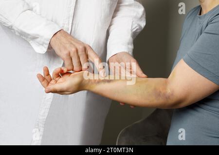 Der Arzt untersucht blaue Flecken am Arm ihres Patienten. Medizin und Behandlungskonzept Stockfoto