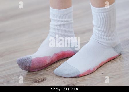 Schmutzige Beerenflecken auf weißer Kleidung. Eine nicht erkennbare Person, die auf den schmutzigen Boden trat und seine weißen Socken verschmutzte. Daily Life Flin Concept. Stockfoto