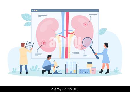 Nierenerkrankung, Nephrologie-Vektorillustration. Cartoon Tiny Doctors studieren Wissenschaft Infografik der menschlichen Niere mit Lupe, Nephrologen erforschen Patienten Physiologie und Symptome Stock Vektor