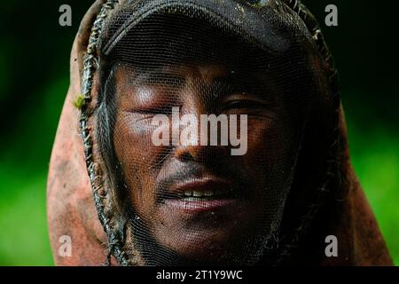 5. Juni 2023, Sindhupalchowk, Nepal: Das linke Auge eines Honigjägers ist geschwollen, nachdem ihn wilde Bienen gestochen haben, als er am Montag, 5. Juni 2023 im nepalesischen Bezirk Sindhupalchowk Wildhonig sammelte. während mutige Individuen sich in die verräterischen Klippen wagen, um den goldenen Nektar der Natur zu suchen. Mit nur einem Seil als Lebensader erklimmen diese Honigjäger große Höhen und riskieren ihr Leben, um die Chance zu haben, in den Höhen versteckte Waben zu ernten. Die ländliche Gemeinde Bhotekhosi in der Sindhupalchowk-Distri Stockfoto