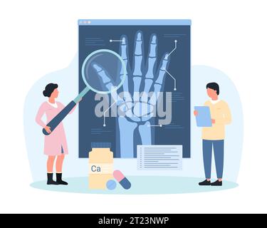 Diagnostik der Arthrose, der rheumatoiden Arthritis mit Hilfe der Röntgenvektorillustration. Karikatur winzige Leute, die eine Lupe halten, um Röntgenaufnahmen menschlicher Handgelenkknochen bei einer medizinischen Untersuchung im Krankenhaus zu untersuchen Stock Vektor