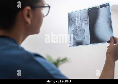 Die Nahaufnahme eines Doktors, der in blauen Schutten gekleidet ist, konzentriert sich auf die Analyse eines Röntgenfilms. Stockfoto