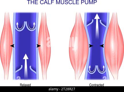 Wadenmuskelpumpe. Venöse Gesundheit. Muskelkontraktion. Beziehungen zwischen Gastrocnemius, Soleus und Blutfluss in tiefen Venen. Venendurchblutung. Huma Stock Vektor