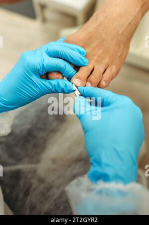 Orthopädischer Arzt in blauen Handschuhen bei der Behandlung der Beine, Nahaufnahme, vertikaler Schuss Stockfoto