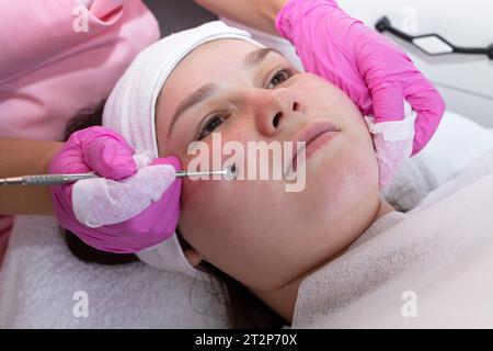 Kosmetikerin Reinigt Gesicht Haut Des Jungen Mädchens Mit Uno Löffel, Stahlgerät Von Akne. Schwarzkopf-Entferner. Mechanische Gesichtsreinigung Stockfoto