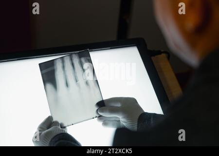 Remscheid, Deutschland. Oktober 2023. Ein Mitarbeiter des Deutschen Röntgen-Museums hält ein Röntgenbild seiner Hand, fotografiert von Wilhelm Röntgen, über einem Leuchtkasten. Historische Röntgenbilder aus dem Museum wurden für das UNESCO-Weltdokumentarerbe nominiert. (Zu dpa: "Röntgen's Pictures - Ein Museum auf dem Weg zum Weltdokumenterbe") Credit: Marius Becker/dpa/Alamy Live News Stockfoto