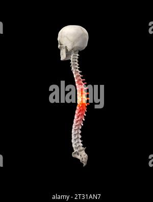 Menschliche Wirbelsäule mit Schmerzen im Thoraxbereich Stockfoto