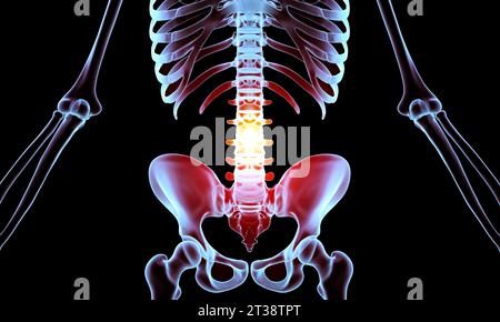 Anatomie der menschlichen Wirbelsäule. Schmerzen im unteren Rücken und menschliche Rückenschmerzen Stockfoto