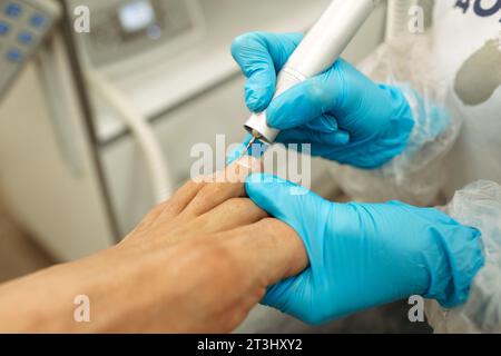 Cropped Kopf Porträt von Arzt Podologie in blauen Handschuhen tun Medizinische Behandlung an den Fingern im medizinischen Zentrum Stockfoto