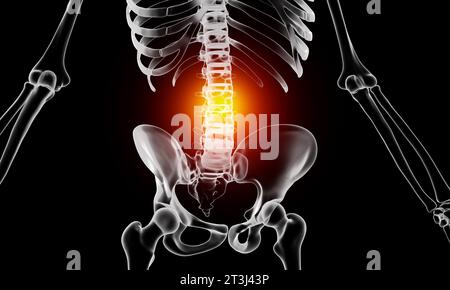 Anatomie der menschlichen Wirbelsäule. Schmerzen im unteren Rücken und menschliche Rückenschmerzen Stockfoto