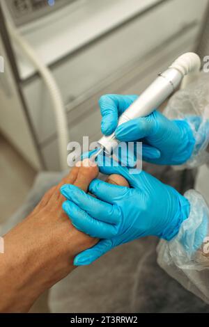 Orthopädischer Arzt in blauen Handschuhen bei der Behandlung der Beine, Nahaufnahme, vertikaler Schuss Stockfoto