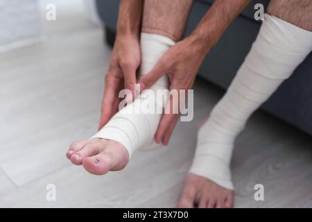 Das Bein des Mannes ist in einen elastischen Verband gewickelt Stockfoto