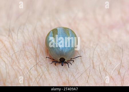 Rizinusbohne Zecke (Ixodes ricinus) weiblich mit Blut auf der menschlichen Haut angesammelt kann Lyme-Borreliose und Zecken-übertragene Enzephalitis verursachen Stockfoto